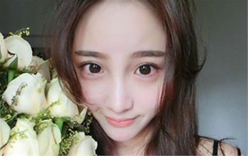 知名网红钟菲羚被毁容 钟菲羚车祸前后对比照惊悚